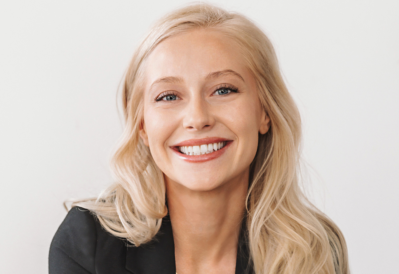 Hannah Boyko, provider for Dermal Fillers, Microneedling, Platelet-Rich Fibrin, PRF, Botox, Dysport, Xeomin, Sculptra, SkinBetter Chemical Peels, Weight Management, Skin Rejuvenation, and Aesthetic Treatments in Bismark ND